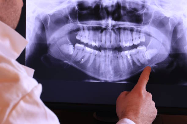Best Emergency Cosmetic Dentistry in Notre Dame, IN