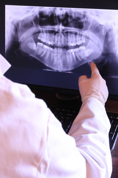 Best Broken or Cracked Tooth Emergency Dentist in Notre Dame, IN