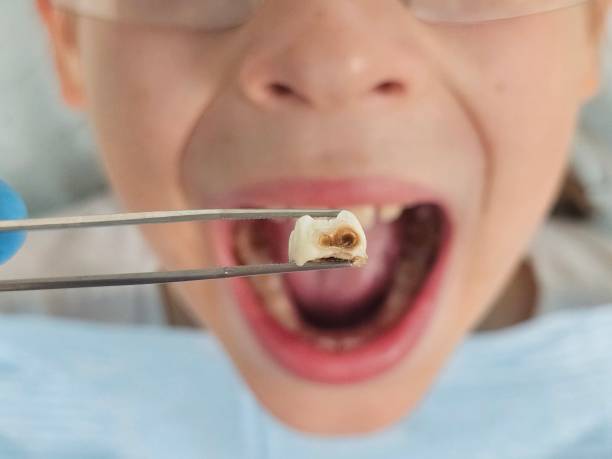 Best Pediatric Emergency Dentist in Notre Dame, IN
